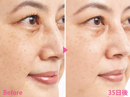 🇯🇵日本 SHISEIDO HAKU melanofocus EV Brightening Serum 驅黑淨白美白精華素美容液|HAKU最高傑作-日本連續18年NO.1 |