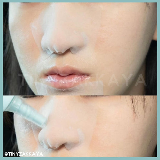 🇰🇷韓國 ILSO Super Melting Sebum Softener 150ml 黑頭粉刺導出液|溫和無痛地溶走黑白頭、軟化老廢角質|